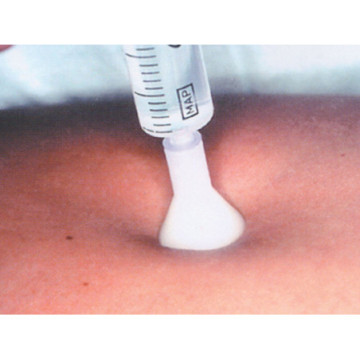 AGO MICRO-MESOTERAPIA - STERILE (31G 0,26x2,5mm) - Confezione 25 pz.