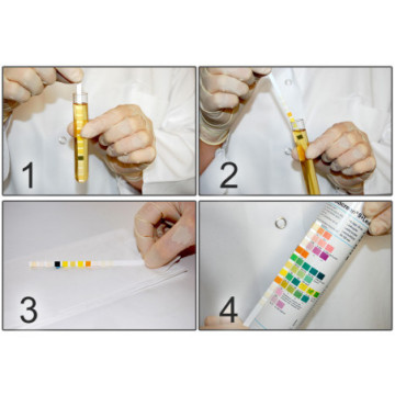 Strisce urine 10 parametri CombiScreen conf. 150 pz.