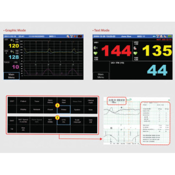 MONITOR FETALE FC1400 GEMELLARE