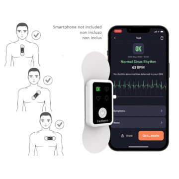 ECG portatile a singolo canale con Afib e BluetoothCardionica® MIR